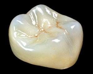 crown2